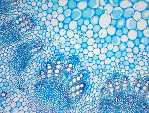 MOTIC PANTHERA系列智能數(shù)碼顯微鏡成像效果