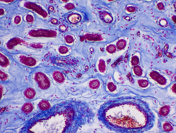 MOTIC PANTHERA系列智能數(shù)碼顯微鏡成像效果